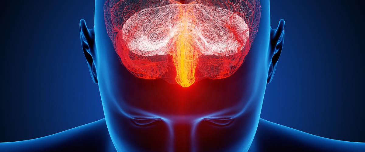 Retinal Migraine Ocular Migraine Symptoms Excedrin Retinal Migraine Ocular Migraine Symptoms Excedrin